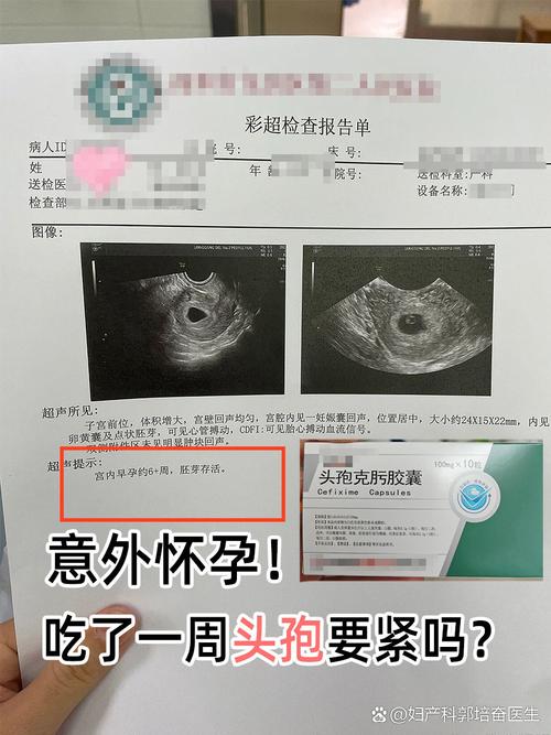 怀孕期间可以打头孢吗-第3张图片-郑州医学网