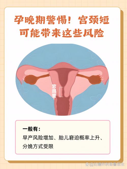 孕期宫颈长度短会影响胎儿吗？需要哪些保胎措施？-第3张图片-郑州医学网