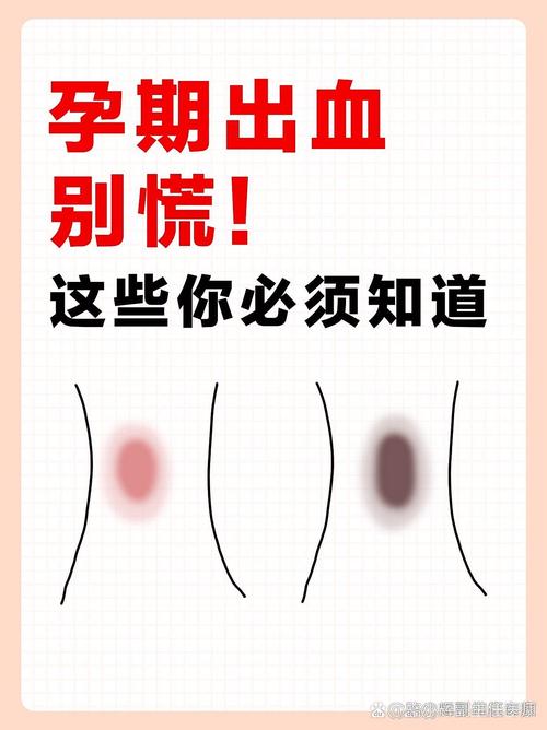 孕期见血是怎么回事啊-第1张图片-郑州医学网