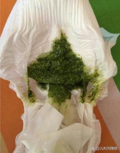 儿童大便绿色怎么回事-第2张图片-郑州医学网