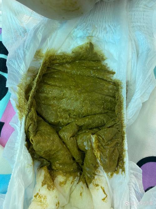 儿童大便绿色怎么回事-第3张图片-郑州医学网