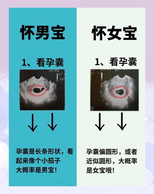 怀孕期间怎样分辨男女-第1张图片-郑州医学网