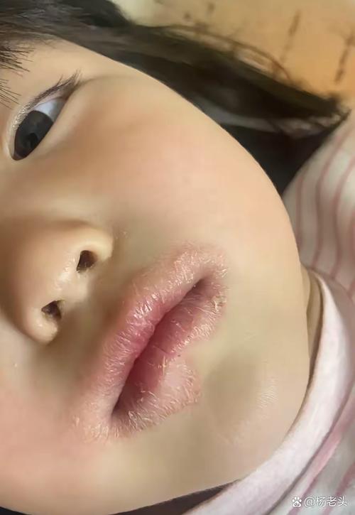 新生儿下嘴唇中间是凹-第2张图片-郑州医学网