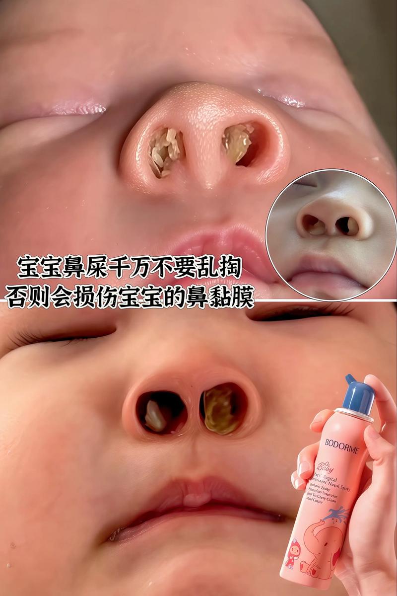 新生儿眼睛不小心被海盐水喷到，会不会刺激眼睛或影响视力？-第2张图片-郑州医学网