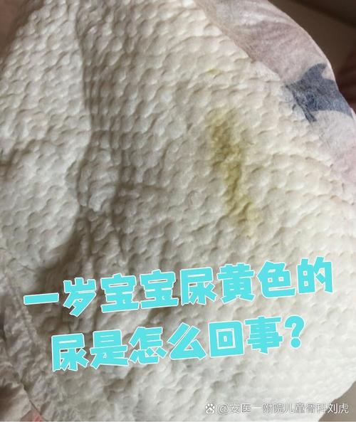 新生儿尿液发黄是上火还是疾病信号？需警惕哪些潜在原因？-第1张图片-郑州医学网