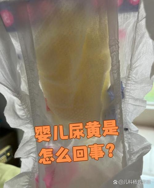新生儿尿液发黄是上火还是疾病信号？需警惕哪些潜在原因？-第2张图片-郑州医学网
