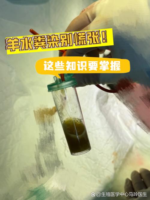 新生儿呛羊水的原因有哪些？会对健康造成哪些影响？-第2张图片-郑州医学网
