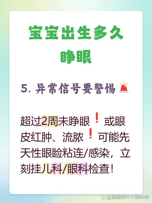 新生儿多久长时间睁眼-第2张图片-郑州医学网