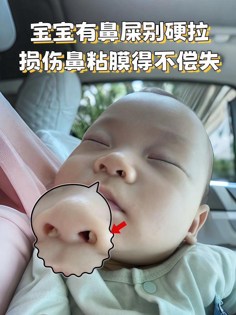 新生儿鼻屎堵塞呼吸怎么办?安全清理方法有哪些?-第3张图片-郑州医学网 新生儿鼻屎堵塞呼吸怎么办?安全清理方法有哪些?-第3张图片-郑州医学网