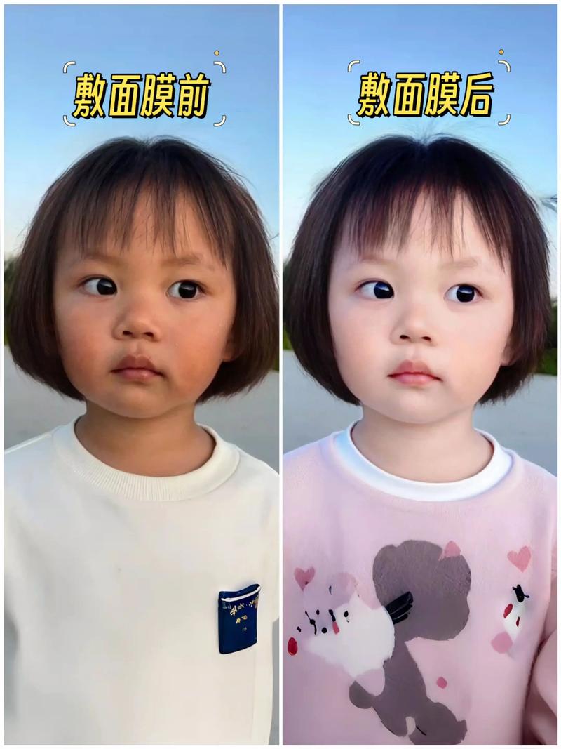 新生儿脸上也会掉皮吗-第3张图片-郑州医学网