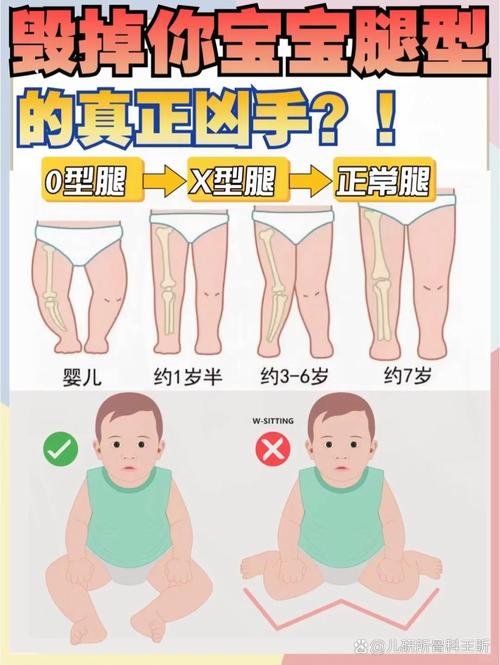 新生儿腿和脚向内弯曲是正常现象还是需要干预的异常情况？-第1张图片-郑州医学网