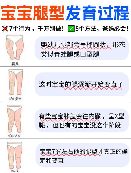 新生儿腿和脚向内弯曲是正常现象还是需要干预的异常情况？-第2张图片-郑州医学网