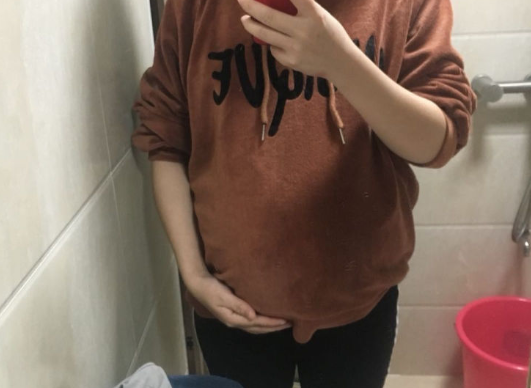 孕期流褐色分泌物且量大，是先兆流产还是异常宫腔出血？-第1张图片-郑州医学网