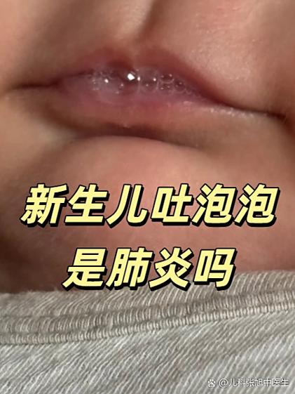 新生儿吐奶是不是肺炎-第3张图片-郑州医学网