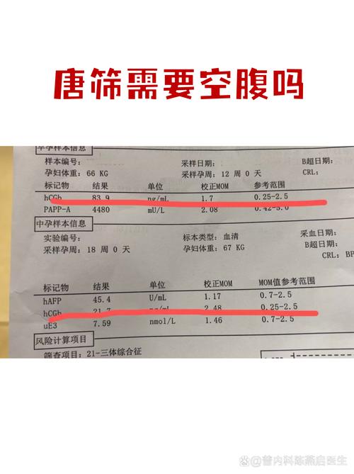 孕期唐筛检查到底要不要空腹？不空腹会影响结果准确性吗？-第2张图片-郑州医学网