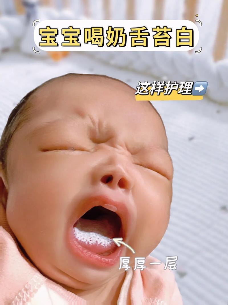 新生儿喝完奶粉总吐舌头是正常现象还是消化异常？-第2张图片-郑州医学网