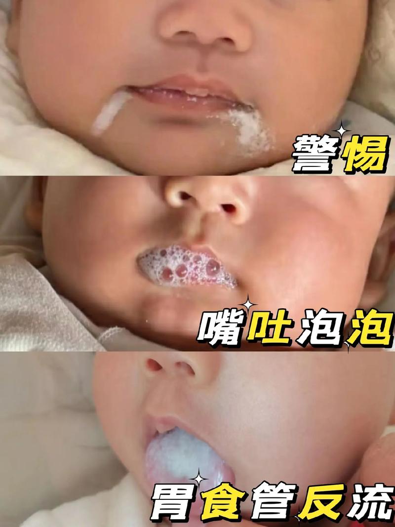 新生儿喝完奶粉总吐舌头是正常现象还是消化异常？-第3张图片-郑州医学网