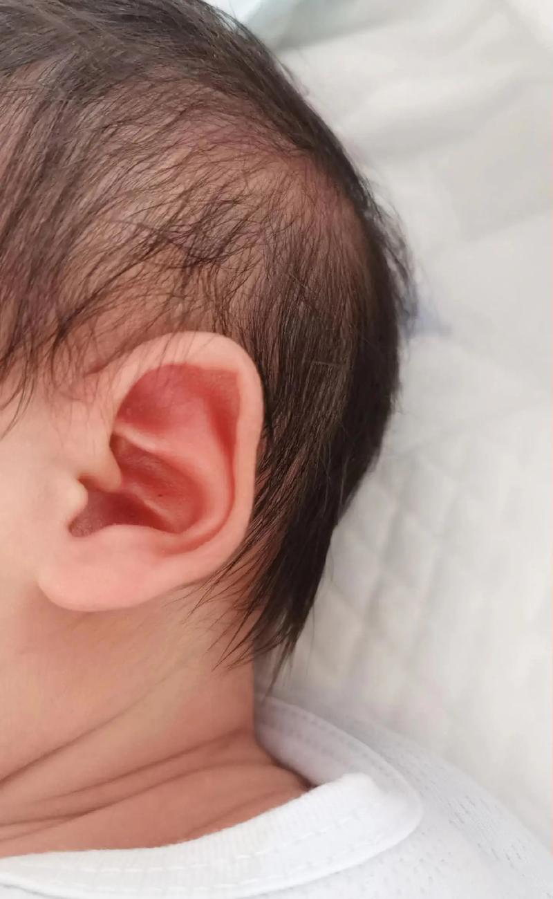 新生儿耳朵里会有胎脂吗？需要清理吗？对听力有影响吗？-第2张图片-郑州医学网