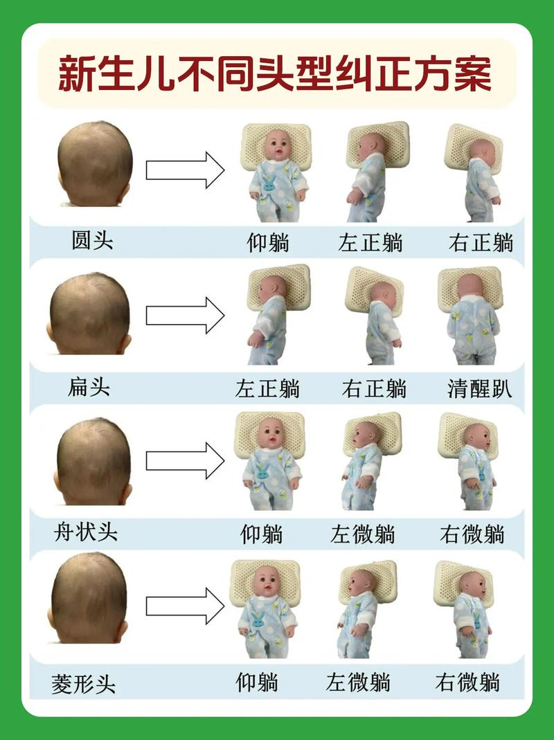新生儿头骨软到底是不是缺钙的信号？需要怎么判断和应对呢？-第3张图片-郑州医学网