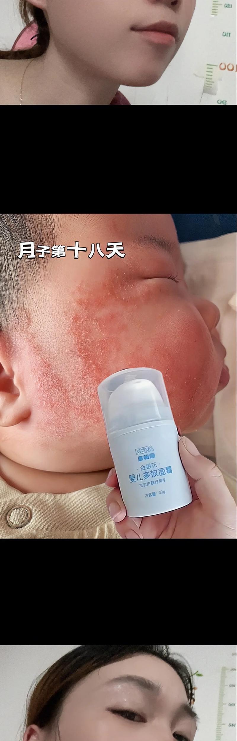 新生儿皮肤娇嫩，脸上到底需不需要涂面霜？涂了会不会有负担？-第3张图片-郑州医学网