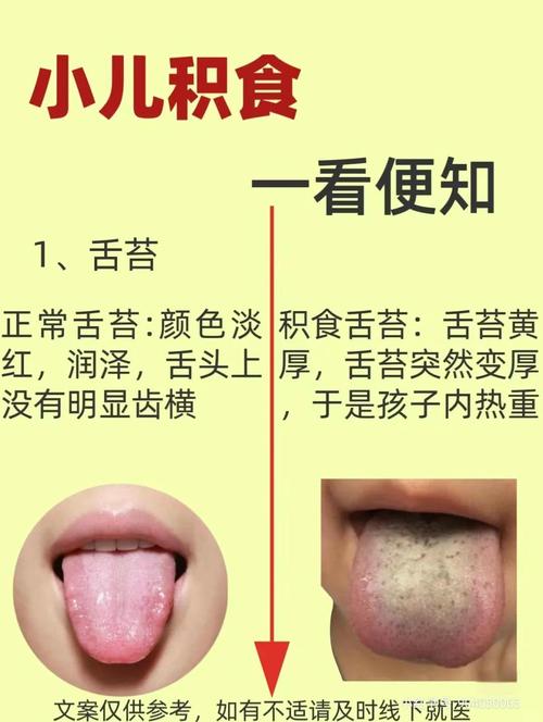 新生儿舌头发白是积食信号？需警惕哪些潜在健康问题？-第1张图片-郑州医学网