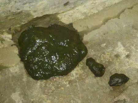 孕期便秘拉的屎是绿色，这正常吗？会对胎儿有影响吗？-第1张图片-郑州医学网