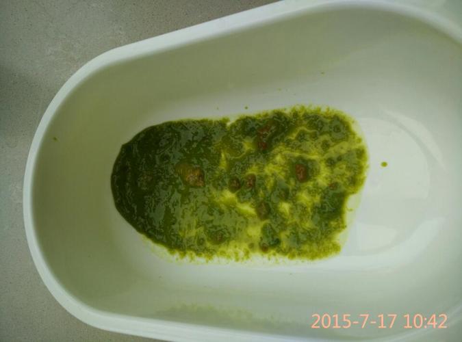 孕期便秘拉的屎是绿色，这正常吗？会对胎儿有影响吗？-第3张图片-郑州医学网