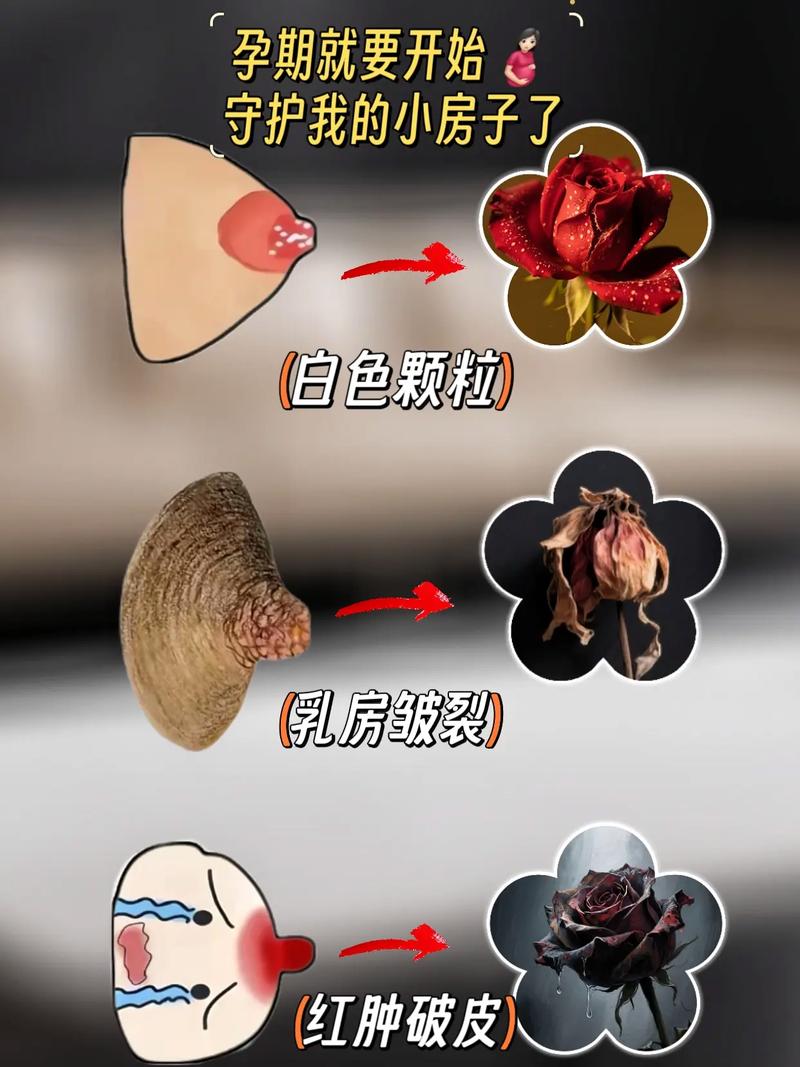 孕期乳晕发硬是正常生理变化还是异常信号？需警惕哪些潜在问题？-第2张图片-郑州医学网