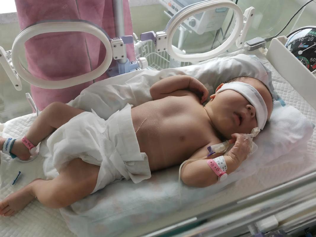 新生儿十二天黄疸10mg/dl需要干预吗？正常范围是多少？-第3张图片-郑州医学网