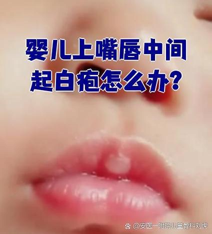 新生儿嘴发白是缺氧还是贫血？新手爸妈该如何正确判断和处理？-第2张图片-郑州医学网