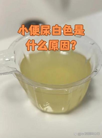 儿童小便出现白色浑浊是哪些原因导致的？需要警惕哪些疾病风险？-第2张图片-郑州医学网