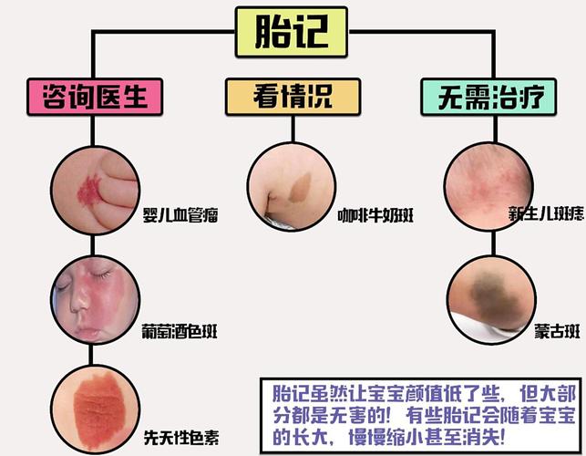 孕期随意碰肚子真的会让宝宝长胎记吗？科学依据到底是什么？-第1张图片-郑州医学网