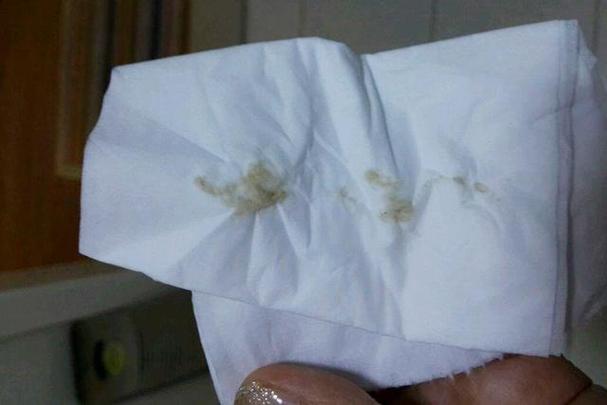 怀孕期间分泌物异常要警惕吗？不同阶段颜色变化代表什么问题？-第1张图片-郑州医学网