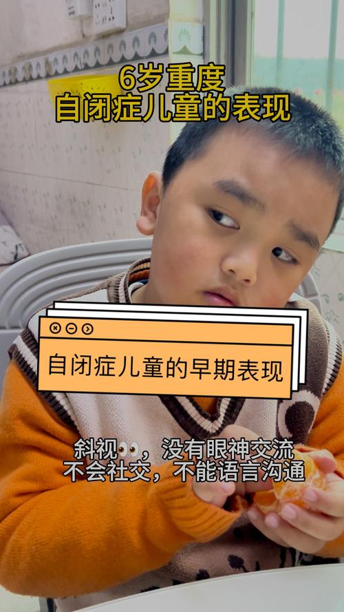 两岁自闭症儿童有哪些典型表现？家长该如何早期识别与干预？-第2张图片-郑州医学网