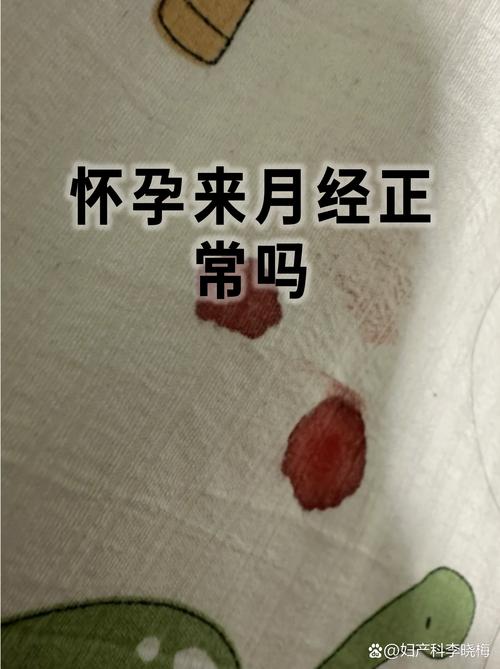 怀孕期间真的会来月经吗？这种情况正常吗？对胎儿有影响吗？-第1张图片-郑州医学网
