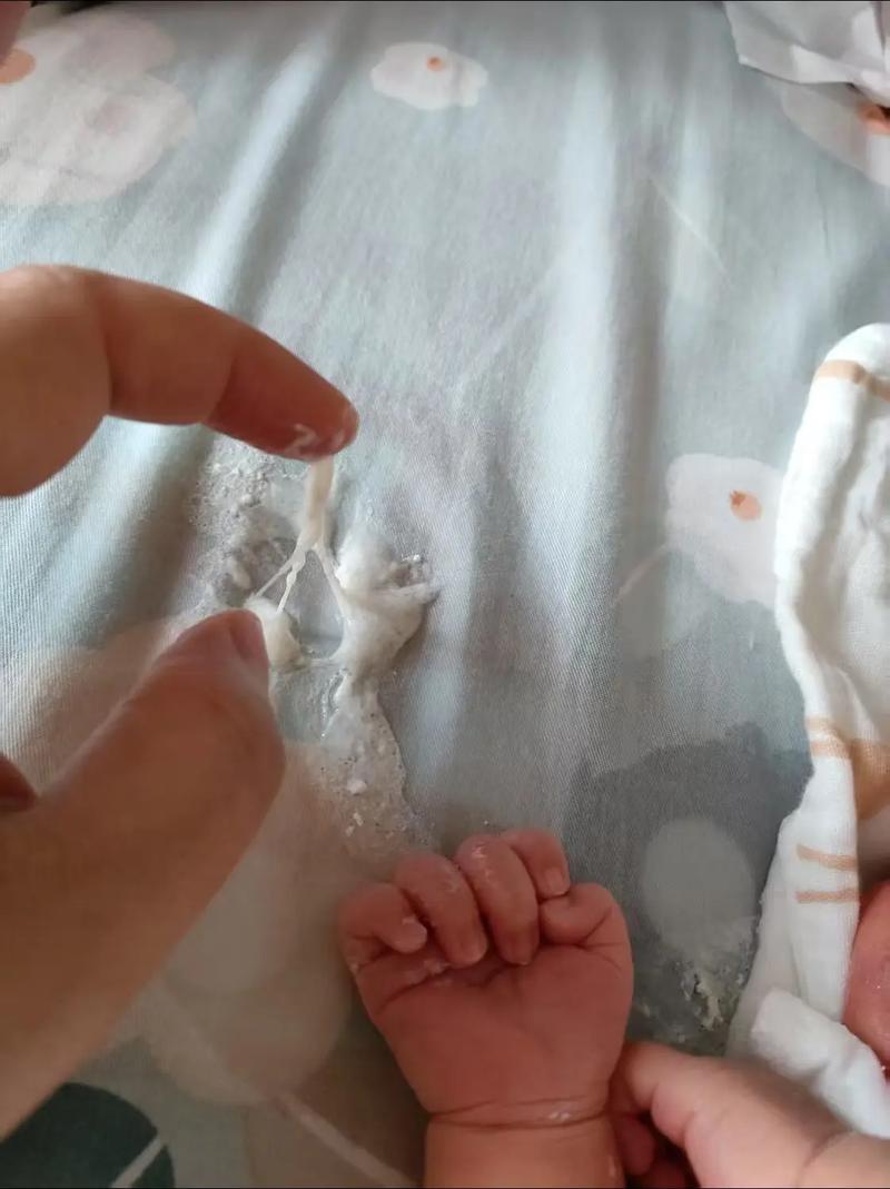 新生儿痰培养细菌感染，常见病原有哪些？如何精准治疗与预防？-第2张图片-郑州医学网