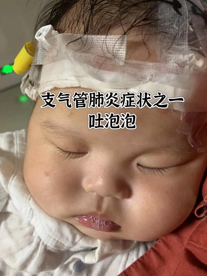 新生儿痰培养细菌感染，常见病原有哪些？如何精准治疗与预防？-第3张图片-郑州医学网