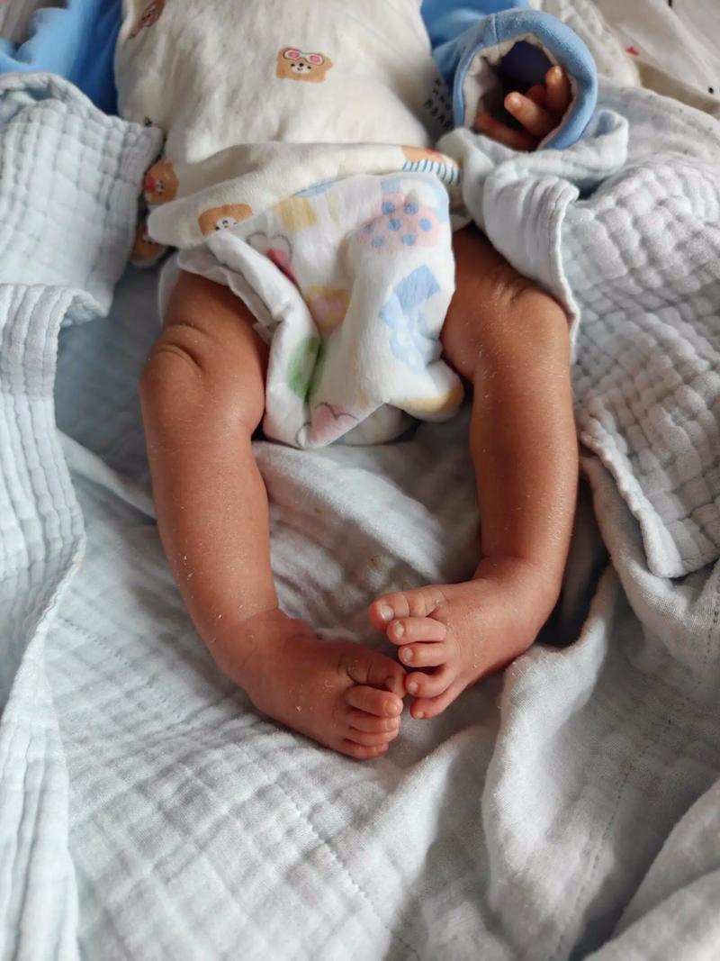 新生儿睡觉脚总是弯曲，是正常生理现象还是需要干预的信号？-第2张图片-郑州医学网