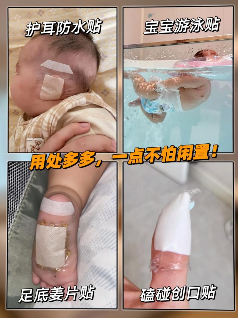 新生儿肚脐凸起是正常现象还是异常信号？家长该如何正确护理与应对？-第3张图片-郑州医学网