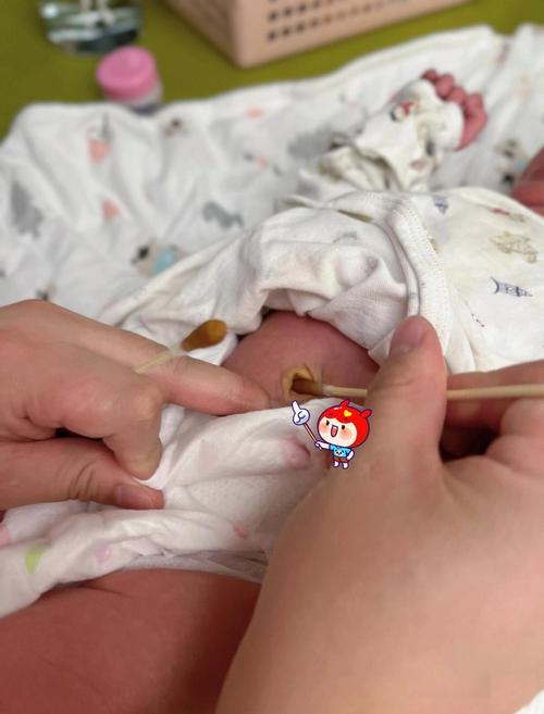 新生儿脐带和纱布粘连后，家长该如何正确处理才能避免感染？-第1张图片-郑州医学网