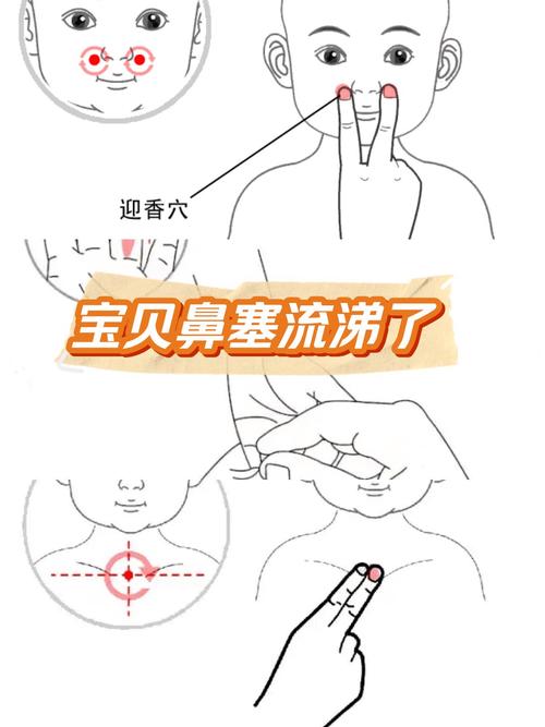 儿童支气管炎推拿手法具体有哪些？操作时需注意哪些事项？-第3张图片-郑州医学网