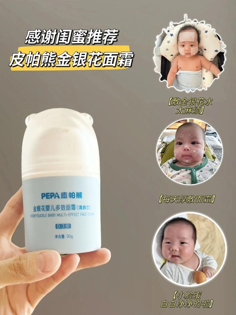 新生儿眼睛额头红点是湿疹还是血管瘤？需要就医吗？-第3张图片-郑州医学网