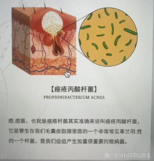 怀孕期间额头频长小痘痘，是激素波动还是营养失衡在作祟？-第1张图片-郑州医学网