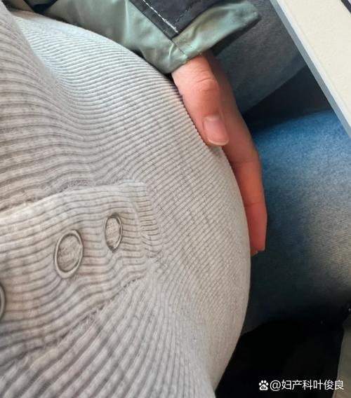 怀孕期间头发掉的厉害-第1张图片-郑州医学网