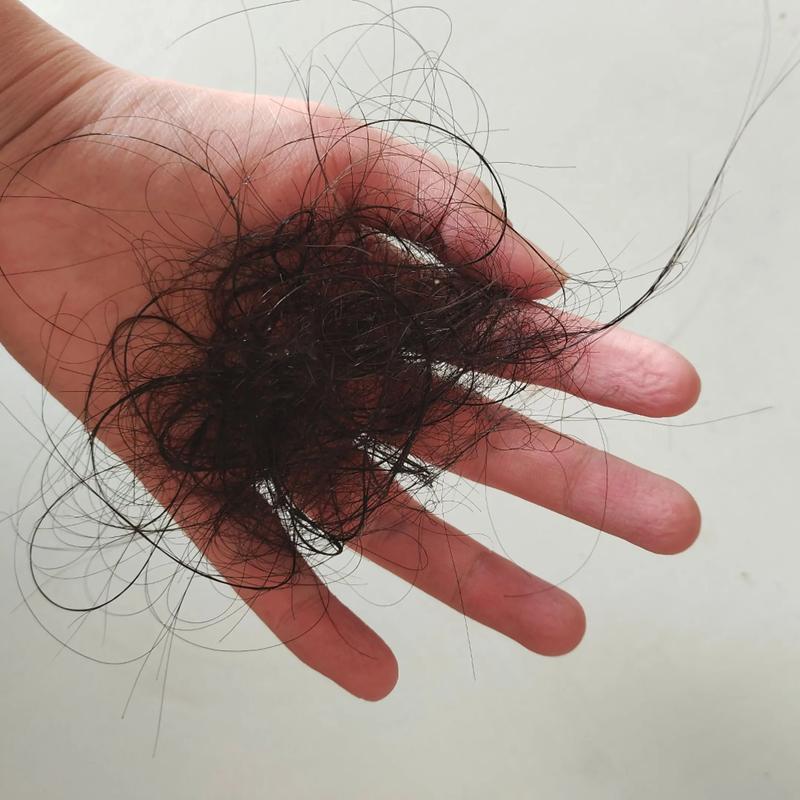 怀孕期间头发掉的厉害-第2张图片-郑州医学网