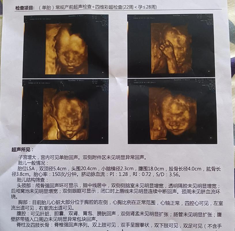 孕期四维彩超到底能做几次？做多了对胎儿有影响吗？-第3张图片-郑州医学网