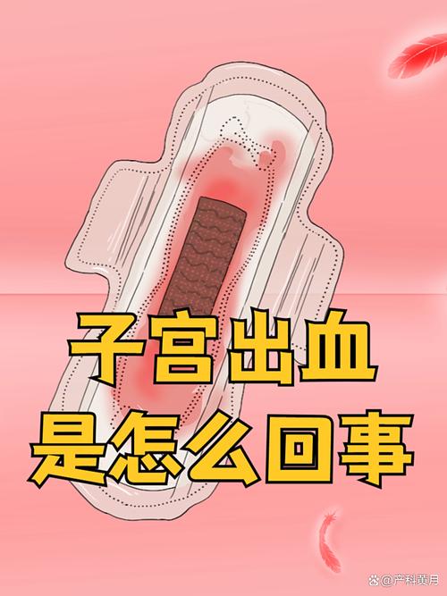 怀孕期间流产是否一定会伴随流血？还有哪些其他症状需要警惕？-第2张图片-郑州医学网