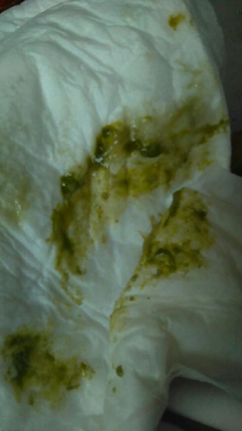 新生儿大便从黄色变成绿色是正常现象还是健康预警信号？-第1张图片-郑州医学网