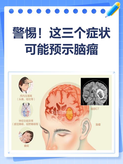 儿童脑瘤的发病诱因有哪些？遗传、环境还是其他未知因素在作祟？-第1张图片-郑州医学网