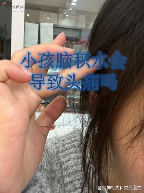 儿童脑胶质增生是否严重？会影响发育吗？需如何治疗？-第1张图片-郑州医学网